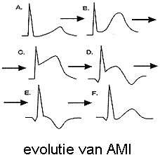 Evolutie van AMI.GIF