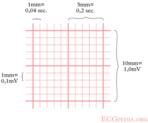 Ecg Rate Determination Chart