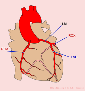 Coronary anatomy.png