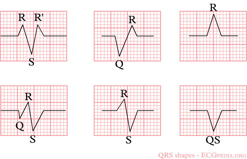 Bestand:Qrs-shapes.png