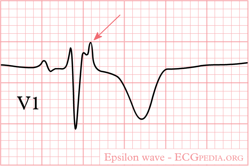 Bestand:Epsilon wave.png