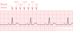 Reading ekg rate