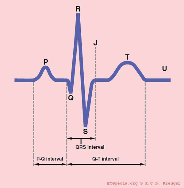 conduction-ecgpedia