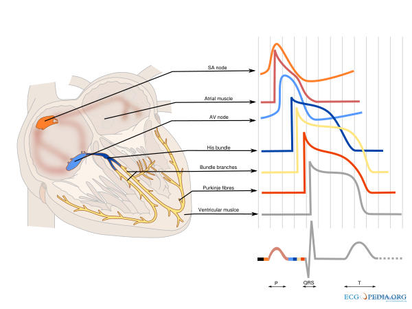 Av Conduction Ecgpedia