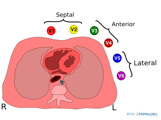 Bestand:Heart position.svg - ECGpedia