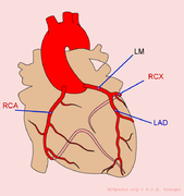 Myocardial Infarction - ECGpedia