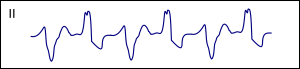 Bb bidir small.svg