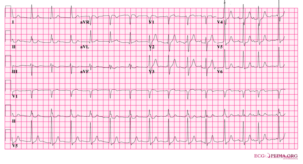 Answer Case 5 Ecgpedia