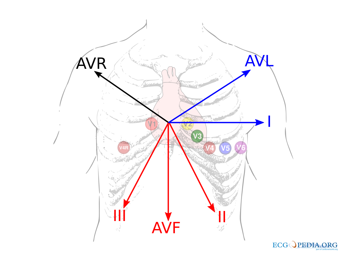 Усиленные отведения экг. AVF AVL отведения это. АВФ отведение на ЭКГ. AVR AVL AVF отведения. AVF отведение.